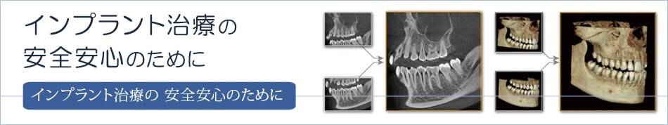 インプラント治療の安全安心のために